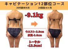 ビーバランス 本町店(美-Balance)/20代前半　月12部位コース