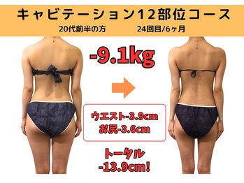 ビーバランス 本町店(美-Balance)/20代前半　月12部位コース