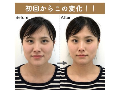 美容整体すこやかの写真