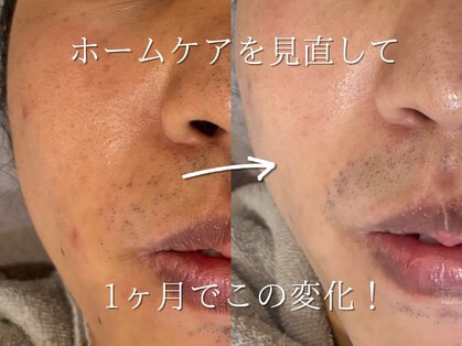 メンズビューティサロン ブレス(bless)の写真