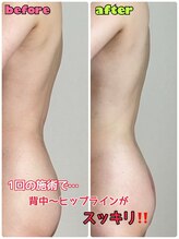 ルミネ(Lumine)/気になる背中・ヒップラインに！