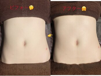 EMI 上野店/#くびれを手に入れたい