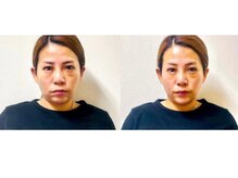 フェイスドット 梅田院(Face.)/