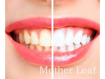 マザーリーフ(Mother Leaf)/