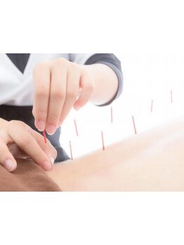 鍼灸施術を受けたい