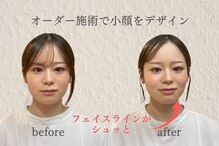 グレース(Grace)