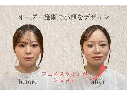 グレース(Grace)の写真