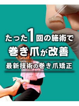 やまと鍼灸整骨院 整体院/巻き爪の施術も可能です!
