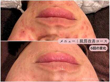 レスイズモア 恵比寿(less is more.)の写真