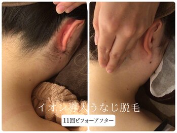 リノ(Lino)/うなじ脱毛シェービング付♪