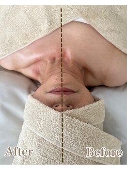 オン 絹(on silk)/小顔筋膜80分/1回施術