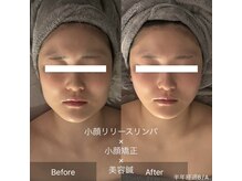 クレラ 恵比寿(CLERA)/ビフォーアフター