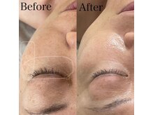 カルナ(CARNA)/陶肌トリートメント★