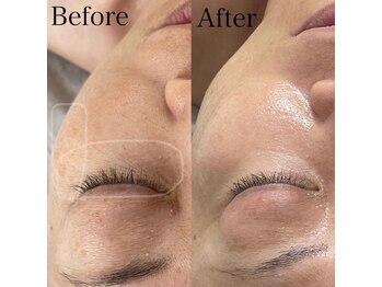 カルナ(CARNA)/陶肌トリートメント★