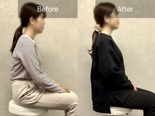 博多おかげ整体院/整体＆姿勢矯正ビフォーアフター