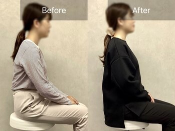 博多おかげ整体院/整体＆姿勢矯正ビフォーアフター