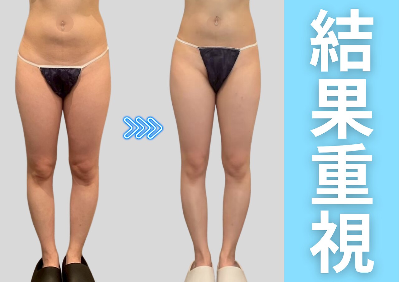 マジビ バイ ルクラ 恵比寿店(MAJI-BI by Lecura)｜ホットペッパー