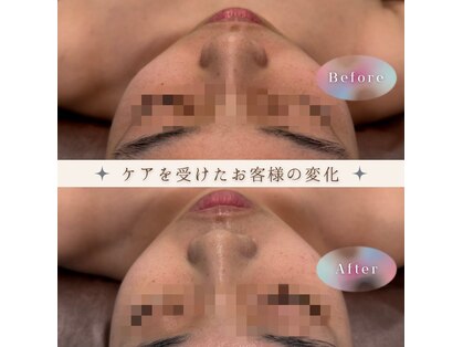 レアリゼ(Re'ariser)の写真