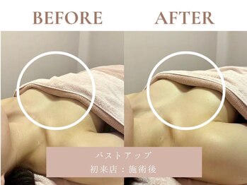 サエラ(SAERA)/光バストアップ【初回】