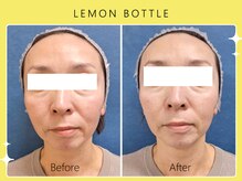 シロカネ 光の森店(SHIROKANE)/レモンボトル☆