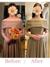 すみれ鍼灸整骨院/神戸　ブライダル美容整体