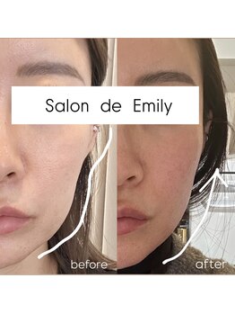 サロン エミリー(Salon Emily)/オンダリフト、ボルニューマ