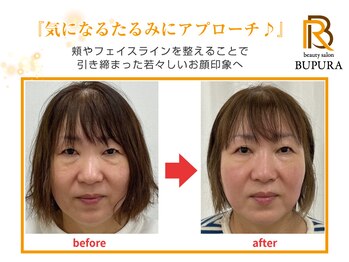 ブプラ つくば店(BUPURA)/before→after　7