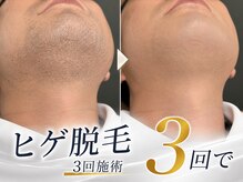 メンズテラス(MEN'S TERAS)