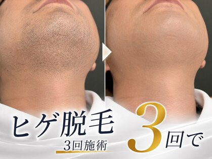 メンズテラス(MEN'S TERAS)の写真