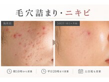 おうちサロン ミキ