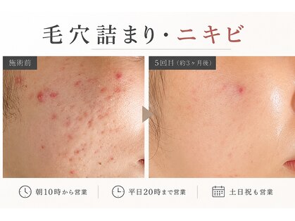 おうちサロン ミキの写真