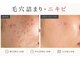 おうちサロン ミキの写真