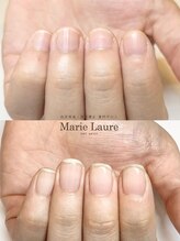 マリーロール 梅田店(Marie Laure)/自爪育成/深爪矯正/ネイルケア