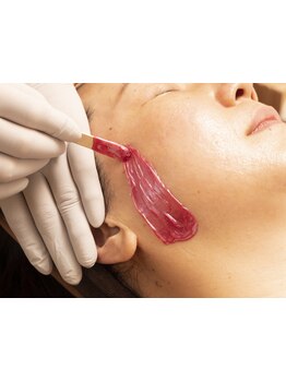 顔脱毛がしたい