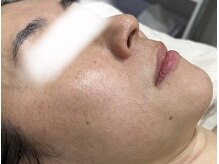 ビューティーサロン アンド ユー シブヤ(Beauty Salon&U Shibuya)/クリスティーナ施術後