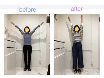 レピア 夙川本店(Lepia)/ビフォーアフターのご紹介♪