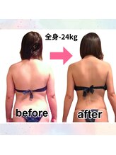 サロンド ヴィーナス 葛西店/全身痩身ハイパーナイフEX