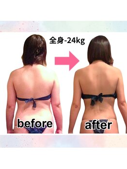 サロンド ヴィーナス 葛西店/全身痩身ハイパーナイフEX