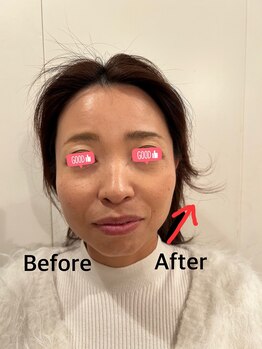 マハロ 海老名店(Mahalo)/小顔矯正　40代女性