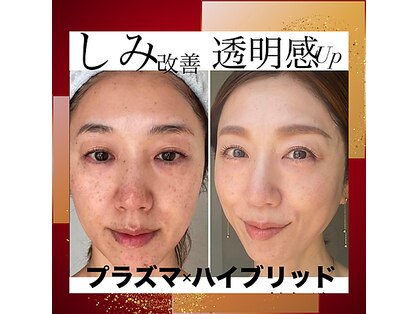 トータルエステティック ジョワイユ(JOYEUX)の写真