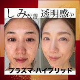 トータルエステティック ジョワイユ(JOYEUX)