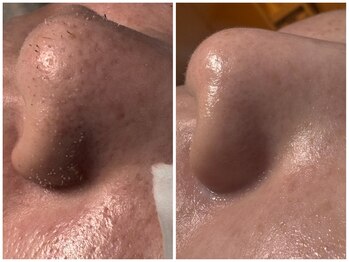 サラグランデ(Sara Grande)/メンズに大人気!脂臭ゼロへ♪