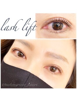 グレイス(grace)/