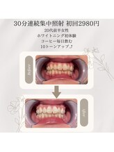プラスビーセルフ(+b self)/ホワイトニングビフォーアフター