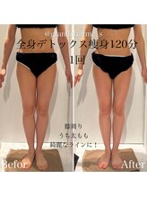 グランドシャルムエス(Grand Charme S)/南森町/痩身/リンパマッサージ