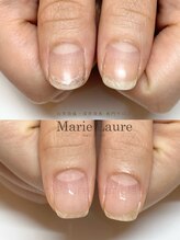 マリーロール 淀屋橋本店(Marie Laure)/自爪育成/深爪矯正/ネイルケア