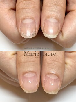 マリーロール 淀屋橋本店(Marie Laure)/自爪育成/深爪矯正/ネイルケア