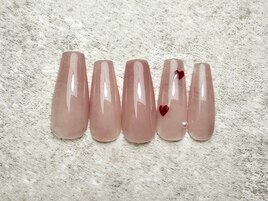 Simple定額