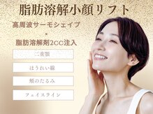 テセラ(Tethere)