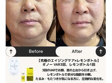 ルームエイトエイティスリー 新宿(R883)の雰囲気（エイジング×レモンボトルも人気！艶肌＆引き締めリフトアップ◎）